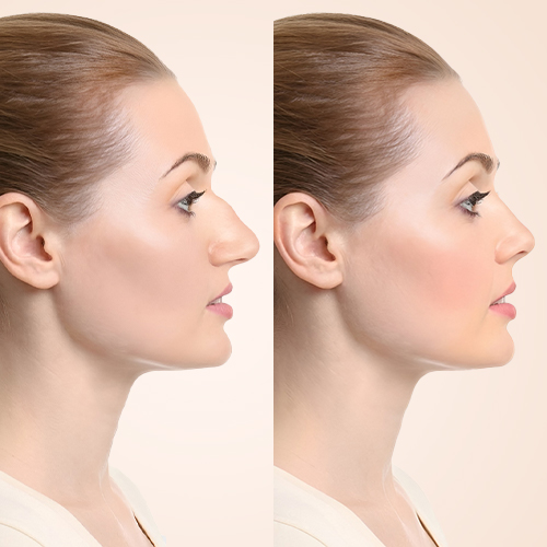 Services Slider Image