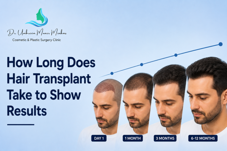 How Long Does Hair Transplant Take to Show Results