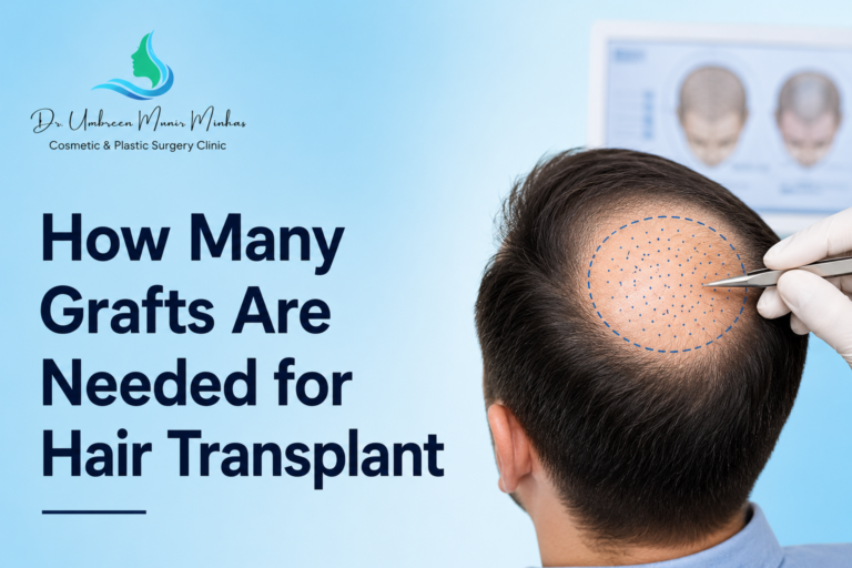 How Many Grafts Are Needed for Hair Transplant