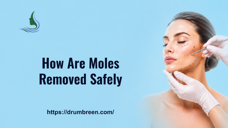How Are Moles Removed Safely