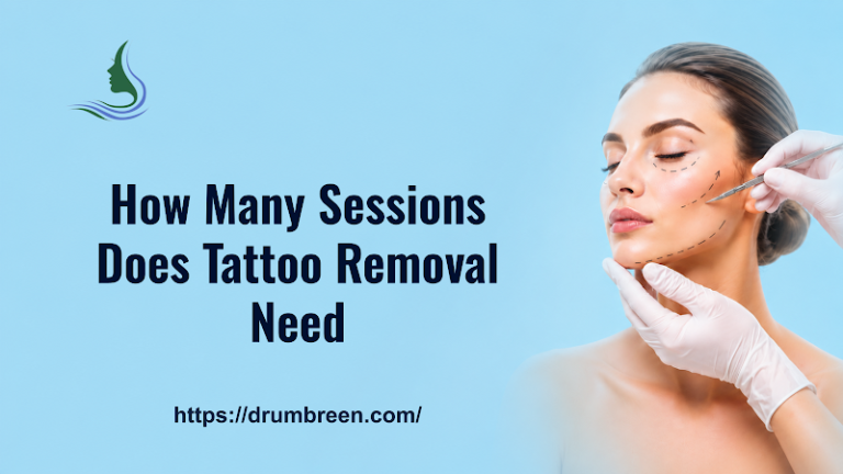 How Many Sessions Does Tattoo Removal Need