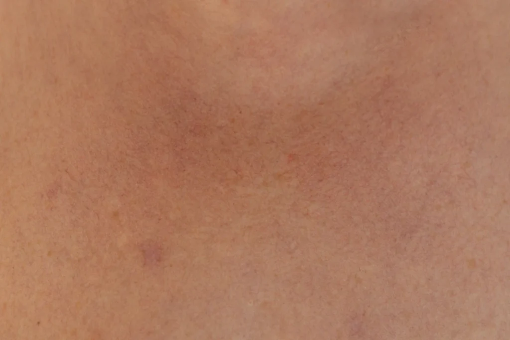 Close-up of skin texture