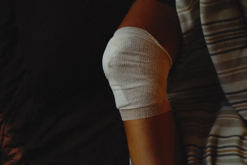 Dressing on the knee, burn treatment in Islamabad