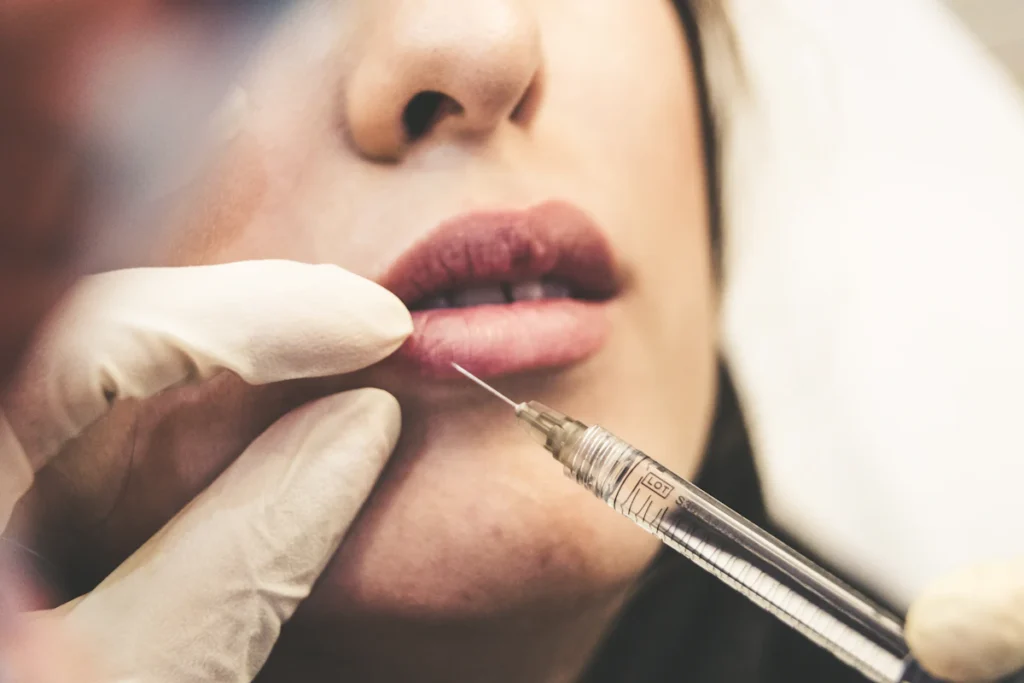 Lip filler injection, dermal fillers in Islamabad