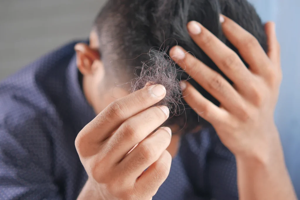Man checking hairline for hair restoration