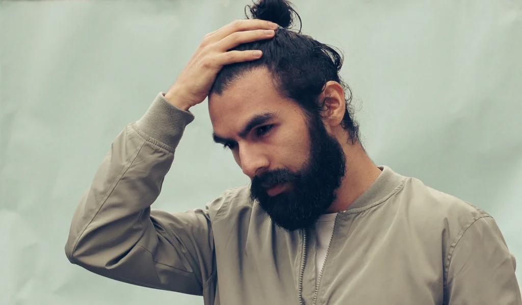 Man with hair concern considering hair transplant