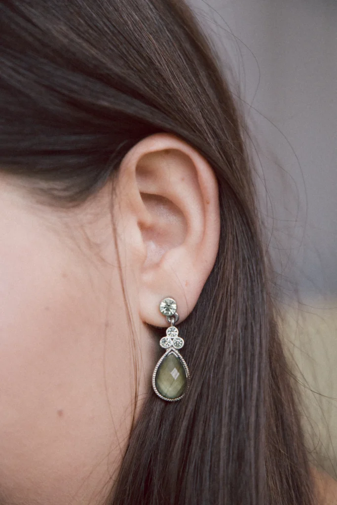 Earlobe with an earring, earlobe repair in Islamabad