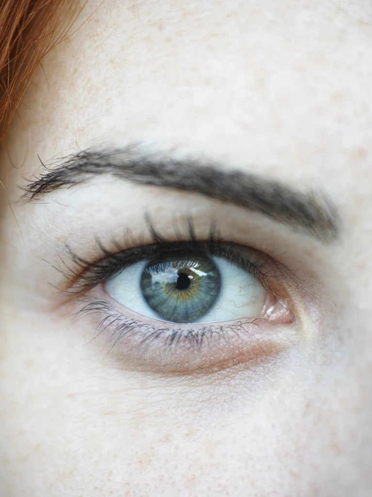 Full eyebrow, eyebrow transplant in Islamabad