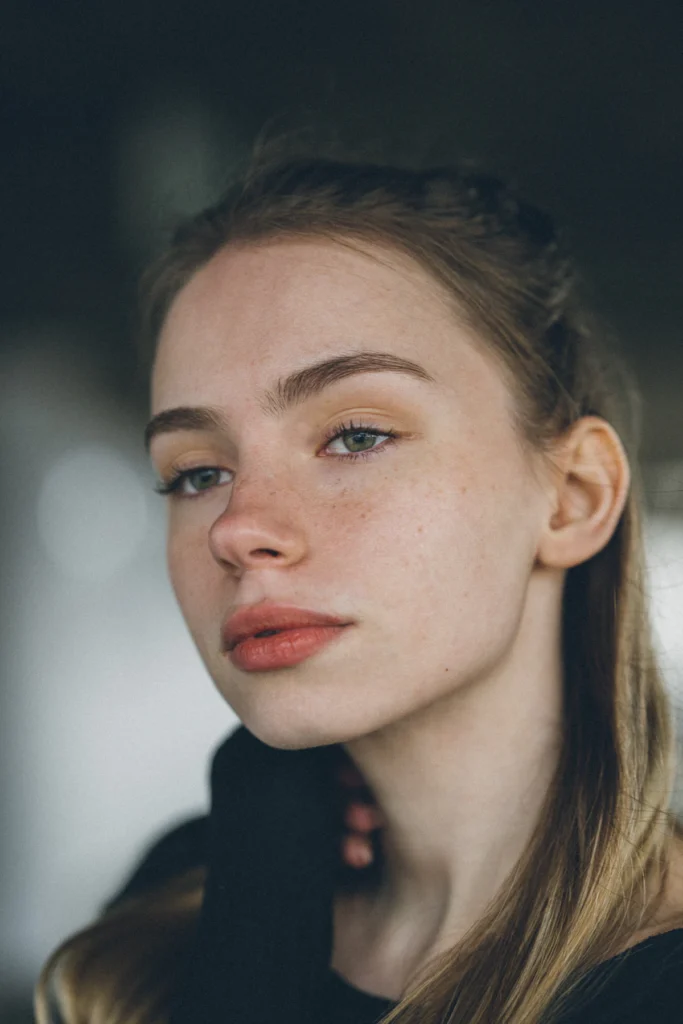 Full, youthful cheeks, facial fat grafting in Islamabad