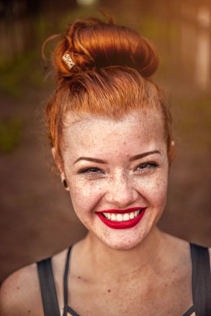 Freckled skin on the face