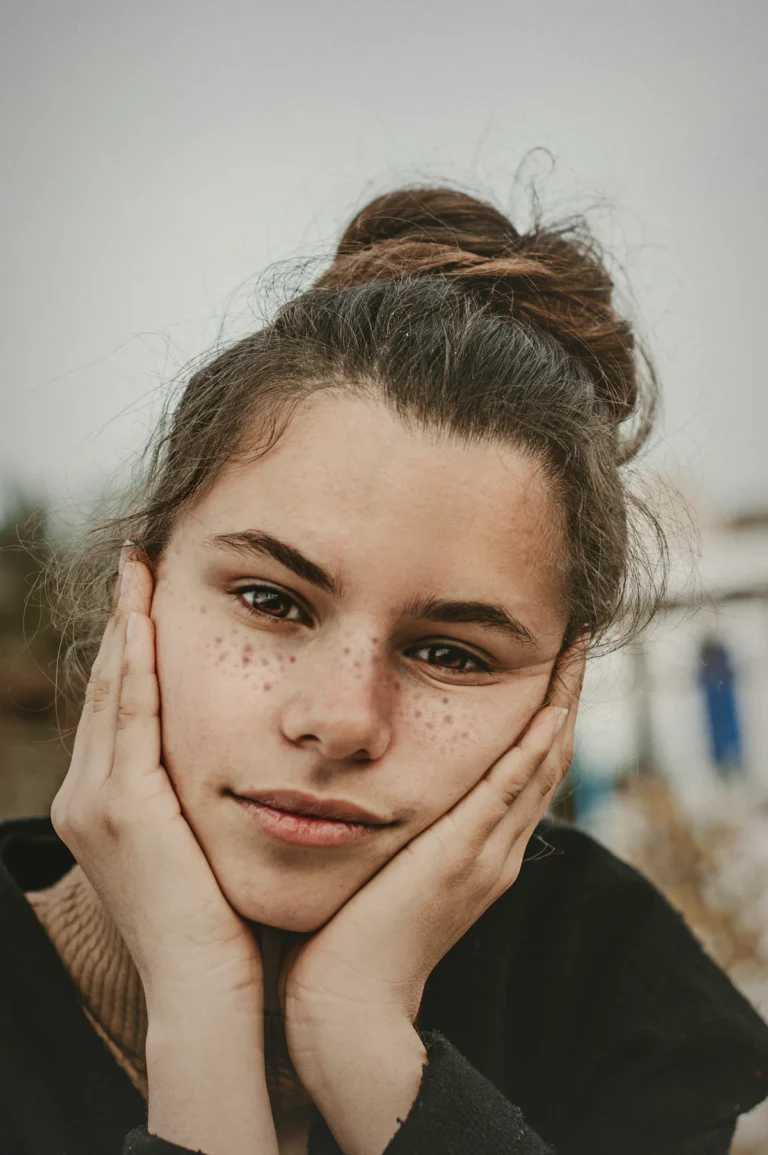 Sun freckles on the cheeks