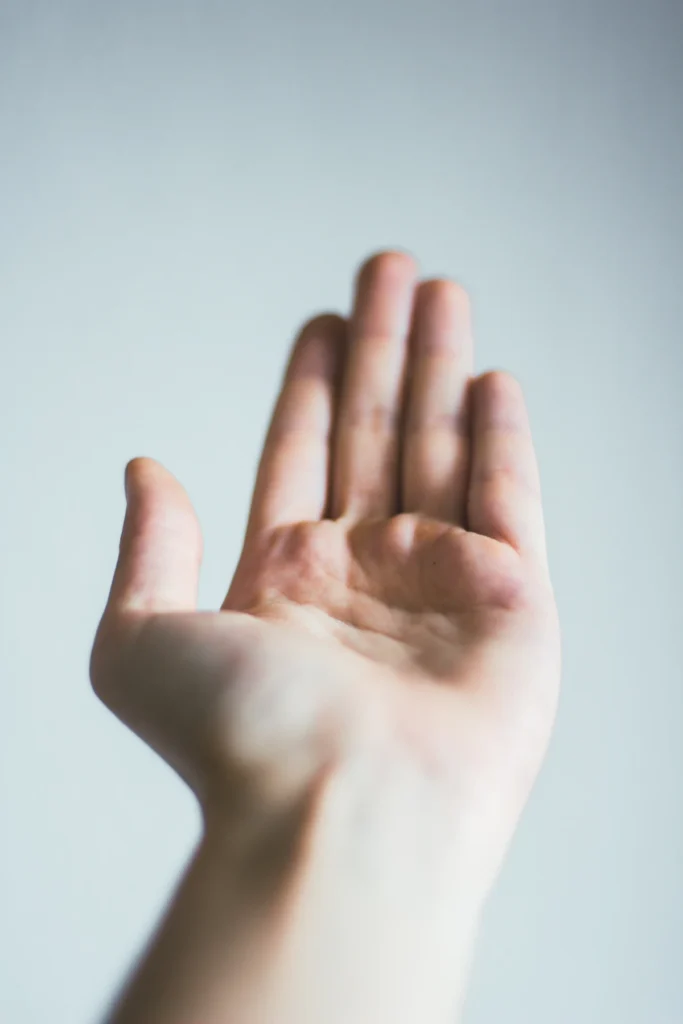 Open hand, hand surgery in Islamabad