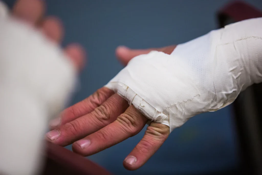 Bandaged hand after surgery