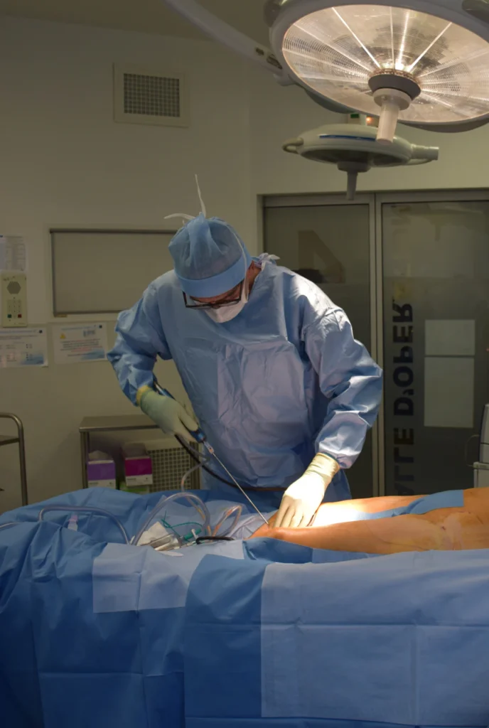 Surgeon performing laser assisted liposuction