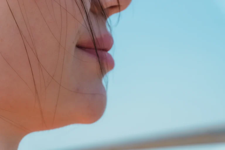 Shorter upper lip with more lip show