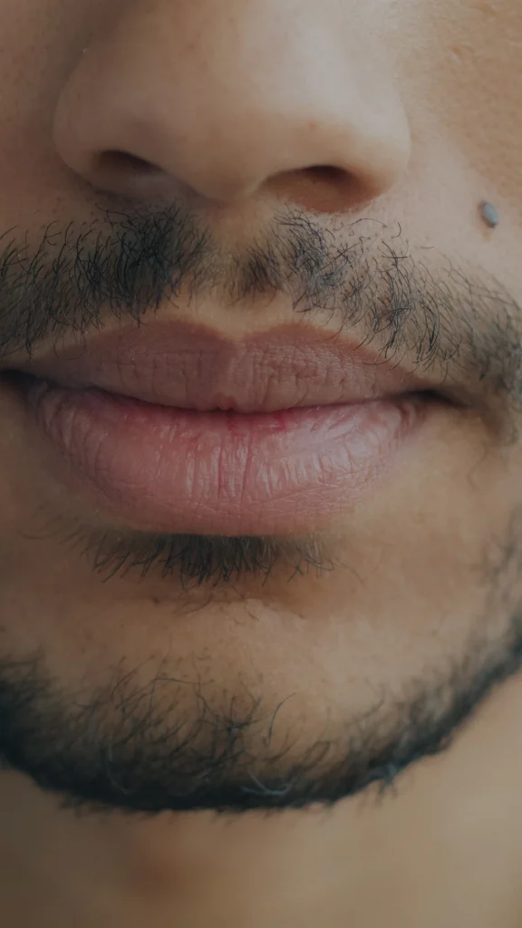 Lips close-up, lip reduction in Islamabad