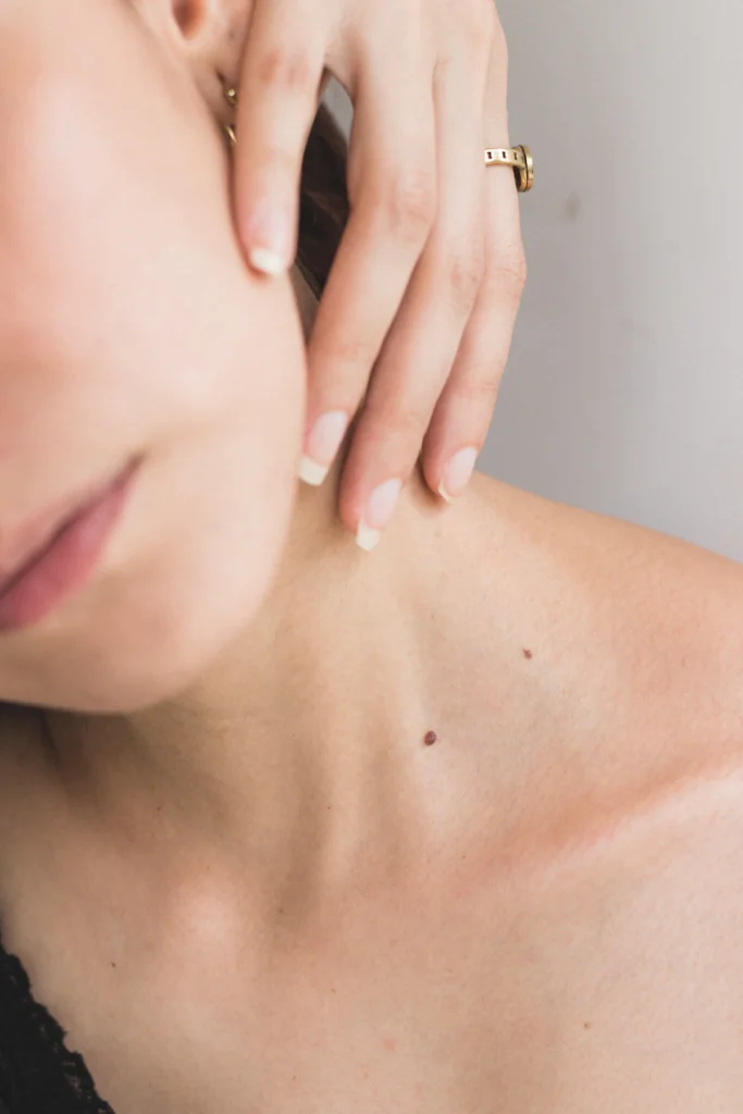 Small mole on the neck