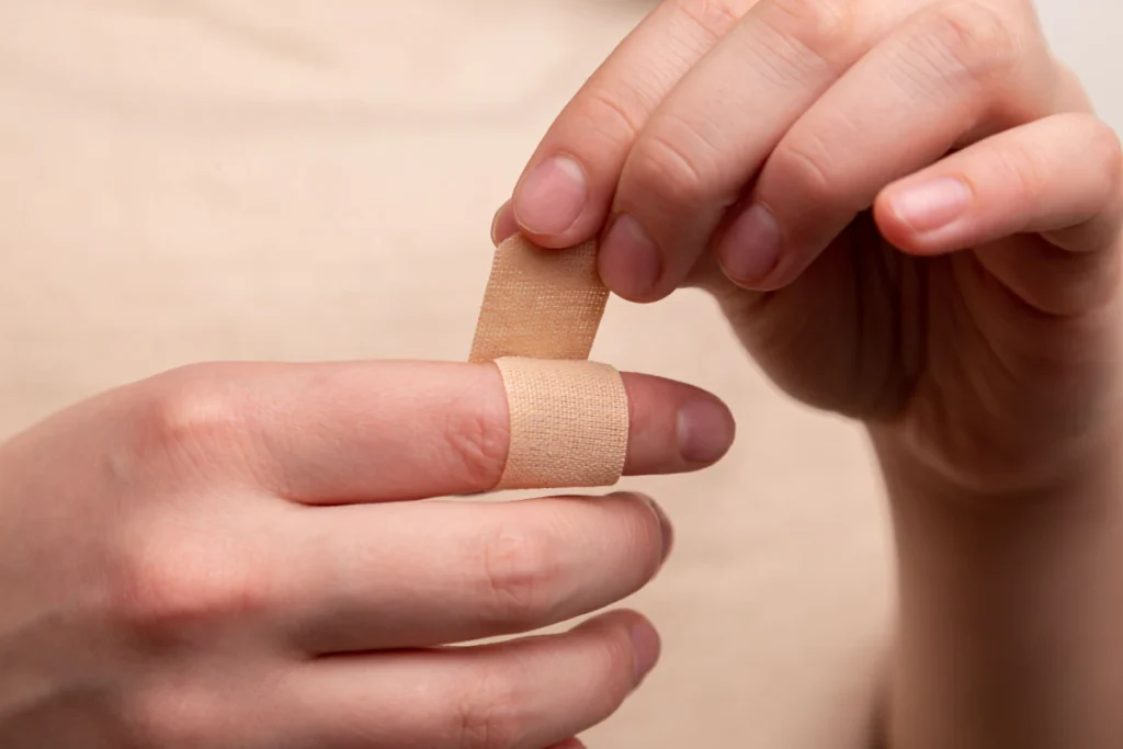 Dressing applied to a small wound