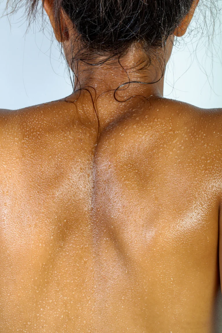 Skin on the back