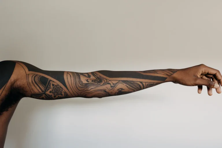 Forearm tattoo before removal planning