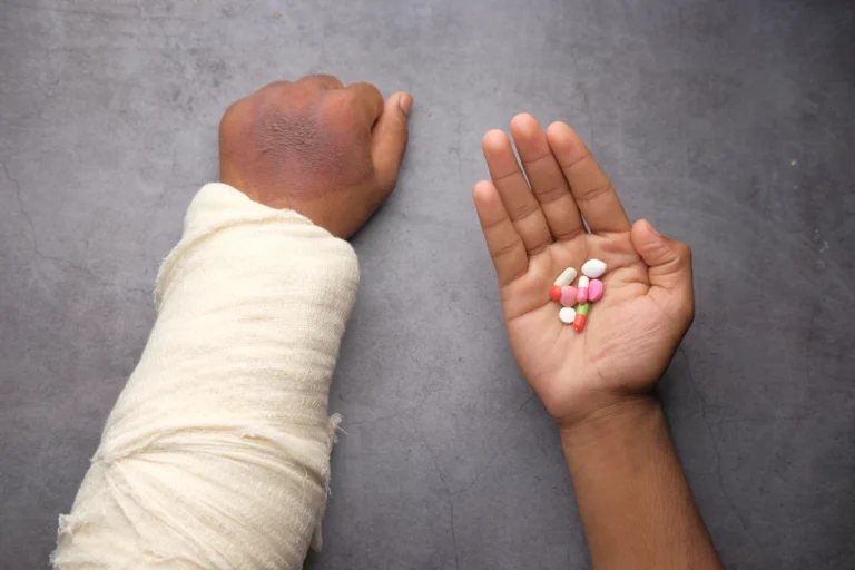 Bandaged arm